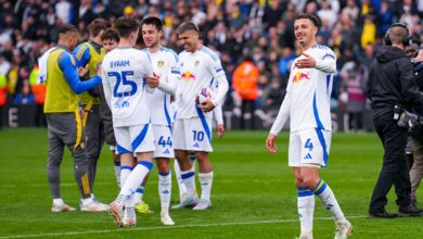 وفاء عين مشجع ليدز: شعار ناديه بدلاً من عينه!